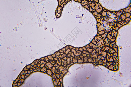 显微镜下凝固的血细胞生物学疫苗病原健康微生物染色体细胞质科学病菌细胞图片