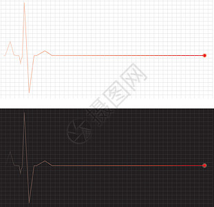 心心电图停止跳动图片