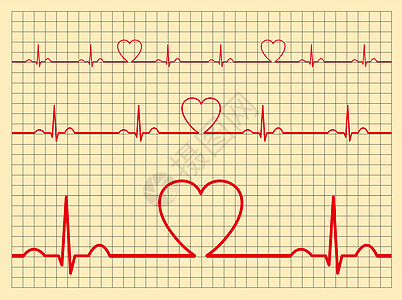 矢心心心心心血管图表集心电图心脏病学网格频率药品脉动专家曲线速度医院图片