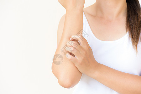 近身女性手臂在家中用手抓痒 健康护理疟疾发痒皮肤科过敏湿疹皮疹保健疾病瘙痒皮肤图片