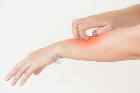近身女性在家中用手抓痒 健康护理皮肤科皮疹痛苦女士湿疹过敏皮炎手臂皮肤划痕图片