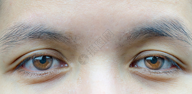 亚洲中年妇女棕色眼睛的宏观照片 眼睛下方有皱纹 眼中有静脉 眼皮问题需要做提拉手术整形男人睫毛眼球鸢尾花成人女性女士治疗眉毛图片
