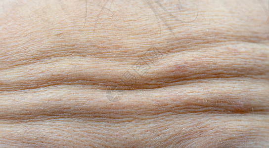 Collagen和肉毒杆菌面部注射概念 更年期妇女面部皮肤干燥前额(乳色更年期女性)图片