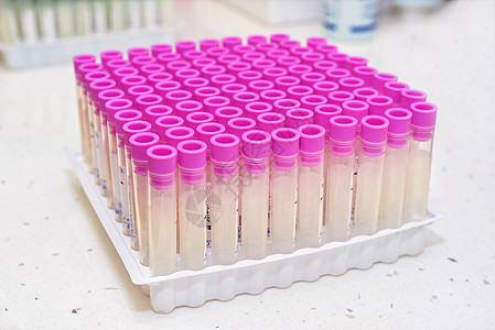 实验室中的空验血管传播医院库蚊考试生物学化学塑料疾病抗原感染图片