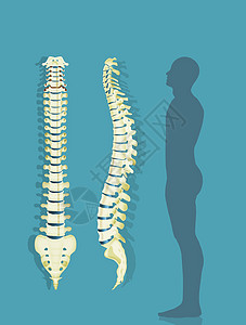 脊椎柱方案骶骨患者腰椎男人解剖学药品插图骨头医生颈椎病图片