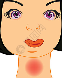 矢量图的喉咙痛的女孩图片