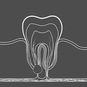 牙科疾病线性图标 牙根炎症 牙根囊肿 牙髓炎的医学插图图片