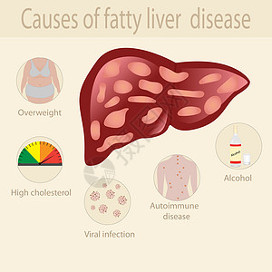 造成脂肪性肝脏疾病的原因图片