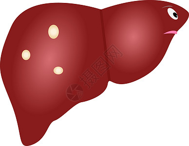 以卡通风格制作的囊状图示为可爱 不健康的肝脏 医学概念卫生保健药品内脏生物学囊肿插图器官医院生理图片