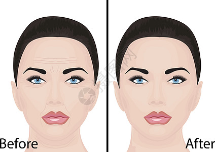 年轻和衰老的面部皱纹治疗面部提升美容手术前后护肤矢量图图片
