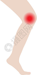 膝膝和脚踝与感染或受伤的间隔图片