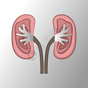 肾脏中的石块 白喉炎 尿利丝虫病 包括图片