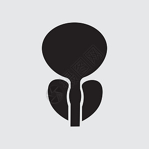 正常前列腺和急性前列腺炎 医学插图 ico图片