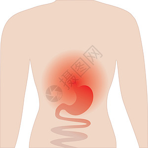 口腔炎 胃痛 矢量插图涂鸦卡通片食物呕吐医师情感疼痛寄生虫症状头晕图片