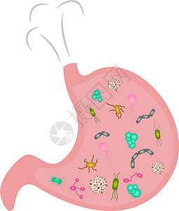 充斥着微生物的腹腔 卡通式图片