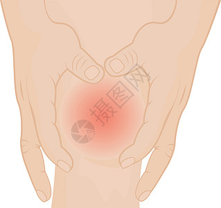 因受伤而膝盖疼痛风险药品肿胀危险伤害损害病人软骨绷带发炎图片