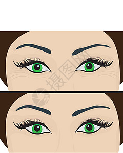 去除眼睛下方的皱纹和细纹 之前和之后 眼睛提升圆圈压力虚胖女士治疗女性治愈皮肤美容症状图片