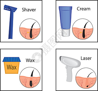脱毛方法及其结果矢量图图片