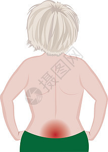 背痛女性身体制作图案矢量图治疗肿胀症状解剖学医学女孩发炎保健创伤运动图片