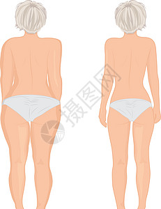 胖瘦的女孩回来了 胖子 抽脂术 之前和之后 它制作图案的女人身体矫正矢量背景图片