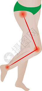 关节疼痛 静态神经 静脉背痛背景图片