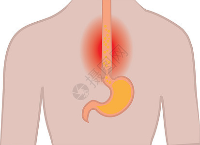 胃部在人体中的心脏灼伤格德腹部 身体中图片