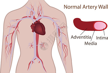 人体动脉系统主动脉血管插图静脉显微镜血栓梗塞动脉粥样硬化危险治疗背景图片
