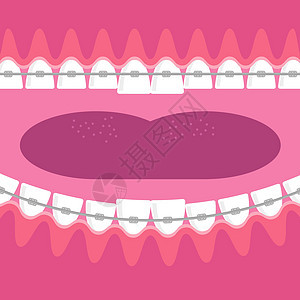 牙齿 牙科护理背景 矫形治疗 卡通开胃口医生金属药品诊所牙医工具嘴唇医院支撑牙刷图片