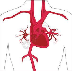 人体动脉系统瘟疫动脉粥样硬化攻击船只差距凝块主动脉动脉硬化封锁血栓图片