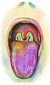 白喉 古代雕刻图片
