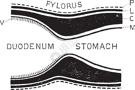 Pylorus的形成 陈年插图图片