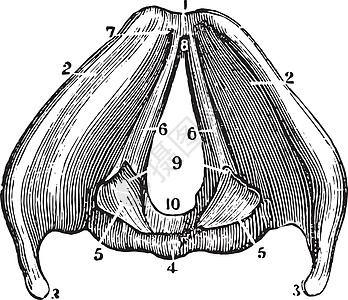 Larynx 显示古老病理的拉林克斯视图图片