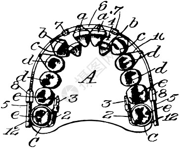 替换假牙古董插图图片