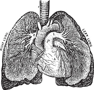 肺动脉复古图图片