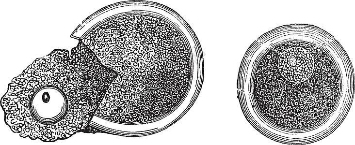 胸腺学 古代刻字插图蚀刻白色艺术雕刻女性女士艺术品绘画精子不育症图片