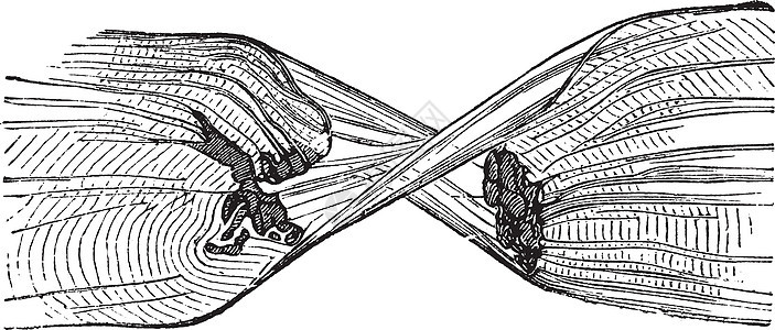 撕破的肌肉纤维 刻有古代文字的插图骨骼解剖学压力肌腱白色躯体胶原艺术品绘画条纹图片