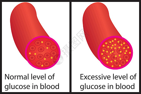 血糖控制正常和过高图片