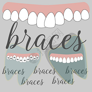 在美丽的风格大括号牙科 矢量平面设计插画成人保健微笑牙齿诊所支撑金属医生牙医插图图片