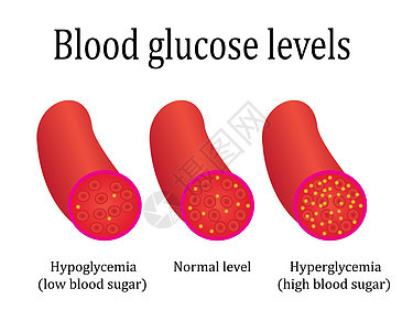 章程血糖水平控制医学实验室分析图片