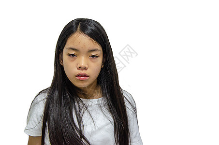 亚裔女孩感染了病毒保健肺炎组织咳嗽疾病流感女士卫生女性支气管炎图片