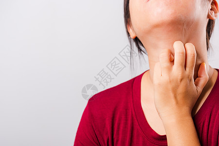 亚裔美丽的女人痒痒痒痒痒的脖子女士治疗刺激皮炎皮肤成人卫生过敏皮肤科疾病图片