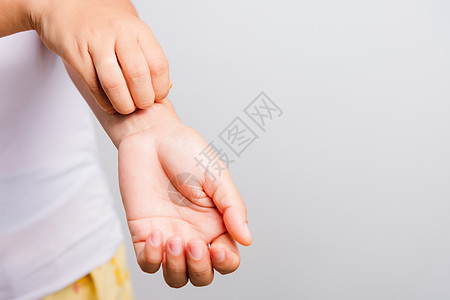 亚裔美丽的女人在用手抓痒痒痒痒肿胀女性疾病皮炎身体女士刺激伤害湿疹症状图片