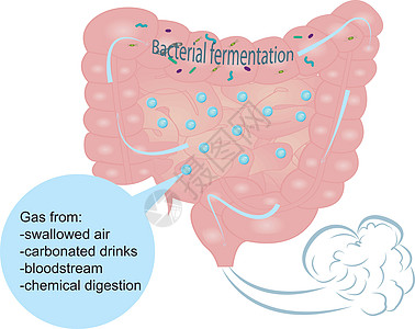肠内胀气和过量气体细菌毒素寄生虫卫生胃炎空气疾病腹胀胃肠病症状图片