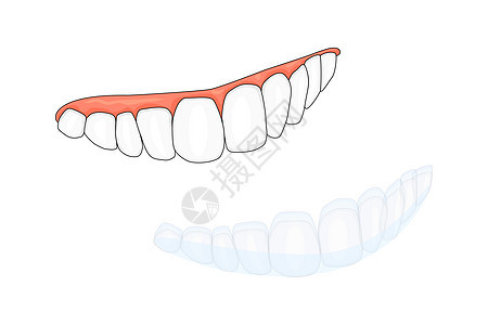 白色背景中隔离的牙齿和隐形牙套或隐形固定器图片
