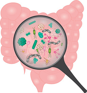 小肠细菌过度生长图片