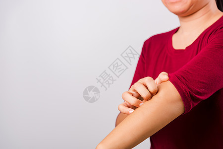 亚洲美女痒痒痒痒痒的手腕治疗保健皮疹蚊子疟疾痛苦手臂药品女性疾病图片