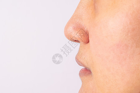 过敏妇女冬季的鼻和嘴唇有湿疹干鼻子和嘴唇cl男性科学皱纹裂缝女孩皮肤科治疗女士面具鼻炎图片