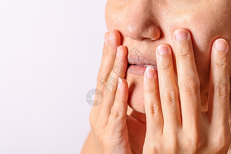 过敏妇女冬季的鼻和嘴唇有湿疹干鼻子和嘴唇cl皱纹皮肤科女孩皮肤戏剧性科学鼻炎面具干旱治疗图片