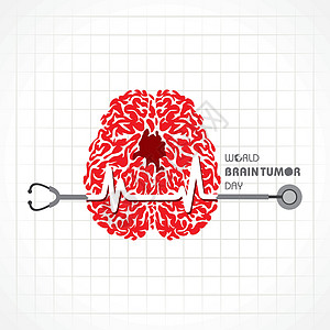世界脑瘤日6 月 8 日 适用于贺卡海报和横幅药品中风国家小脑癌症器官插图风暴大脑丝带图片