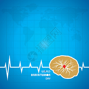 世界脑瘤日6 月 8 日 适用于贺卡海报和横幅插图疾病风暴大脑收藏药品丝带器官身体头脑图片
